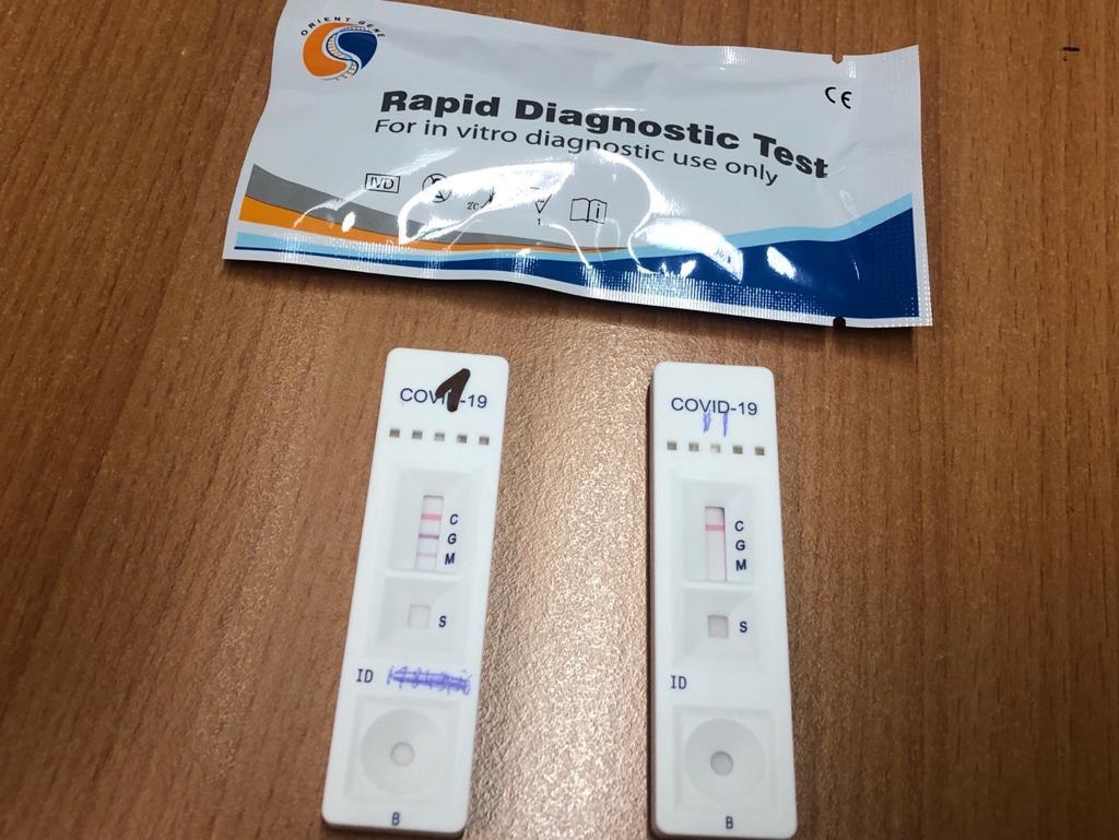 test rapido coronavirus