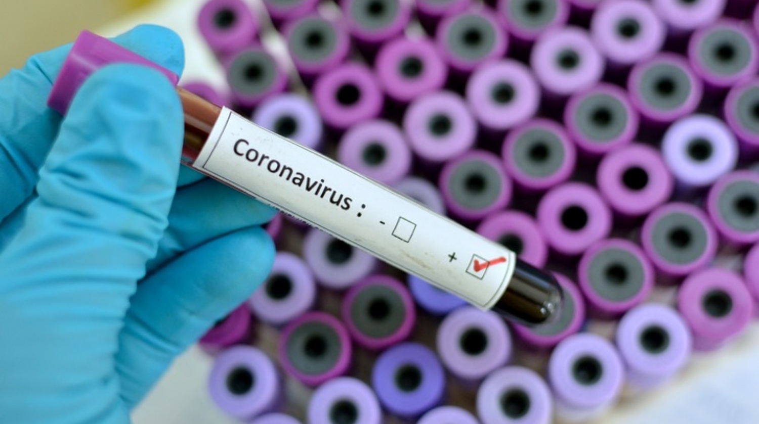 Noticias coronavirus España