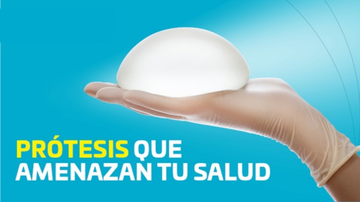 noticias albacete
