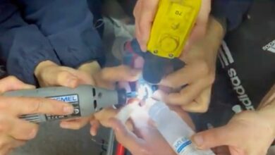 Bomberos acuden a un hospital para sacar un anillo atascado a un adolescente