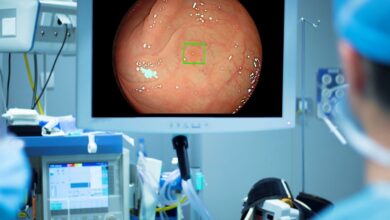 Colonoscopia en Castilla-La Mancha - FOTO DE ARCHIVO