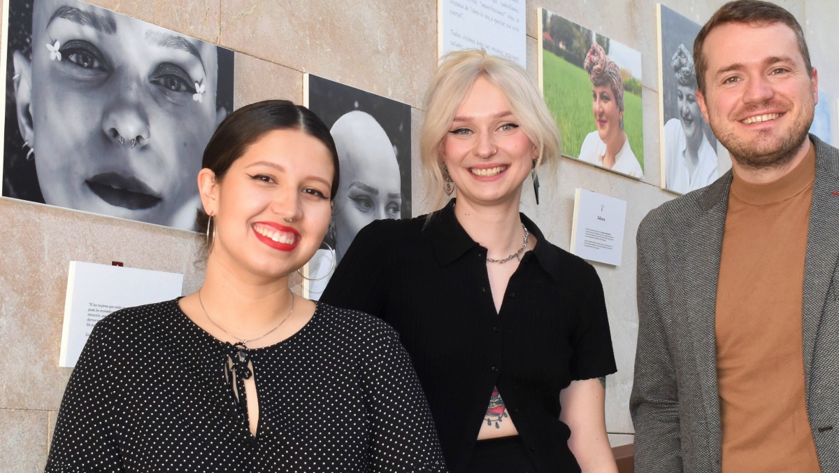Campaña alopecia femenina en Albacete
