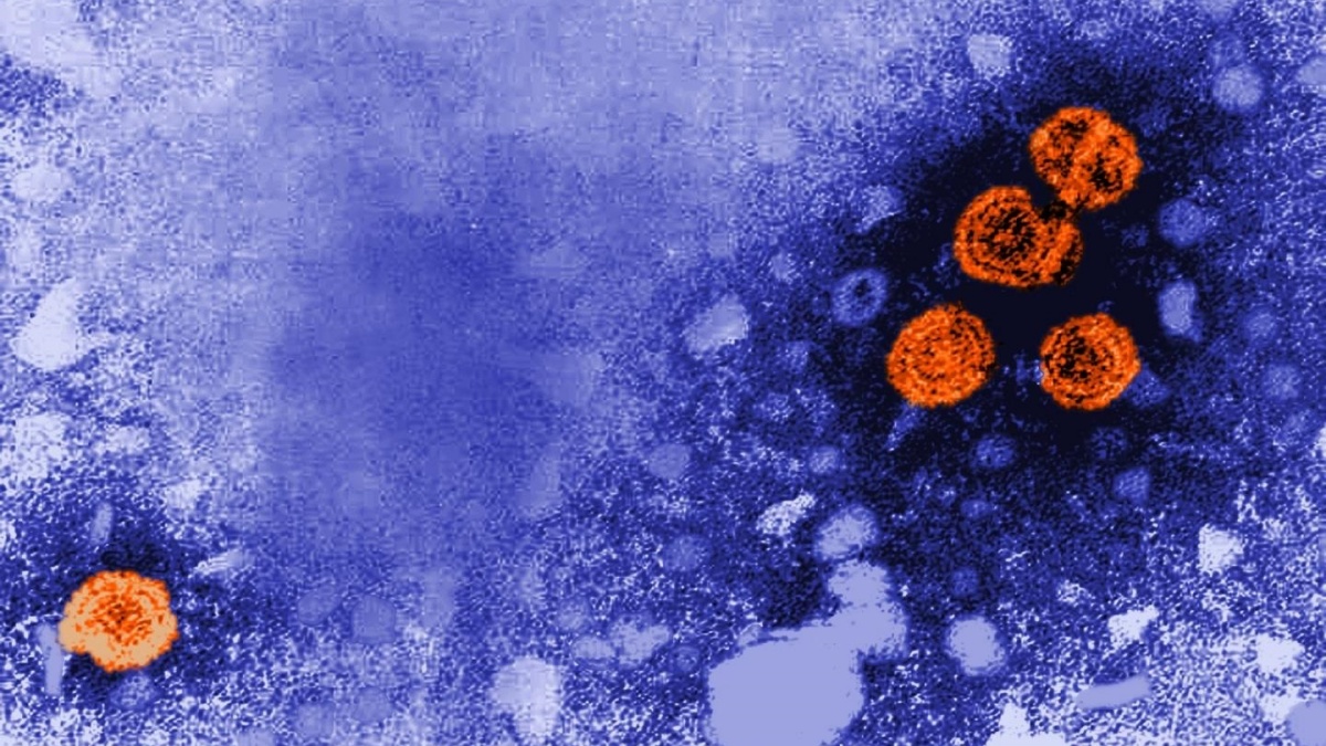 Imagen de microscopía electrónica de transmisión coloreada digitalmente revela la presencia de viriones de la hepatitis B (de color naranja). CDC/DR. ERSKINE PALMER