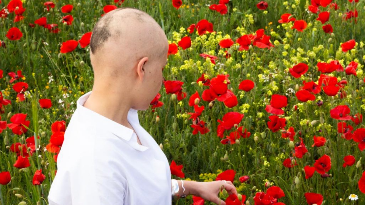 Fotografía de la exposición sobre alopecia femenina / Imagen: Ayuntamiento de Albacete
