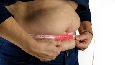 Persona obesa en Albacete