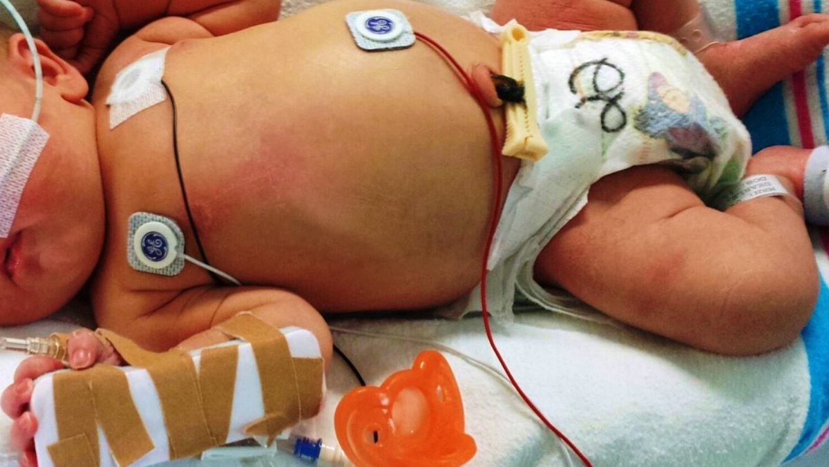 Bebé - Pixabay - Foto de archivo